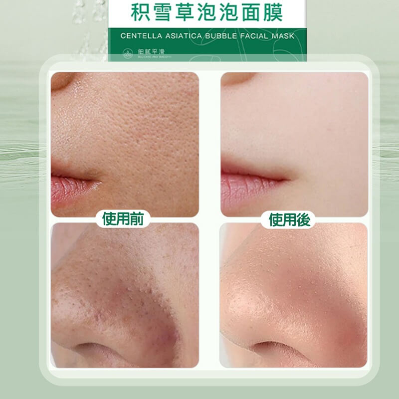 後美博士積雪草泡泡面膜